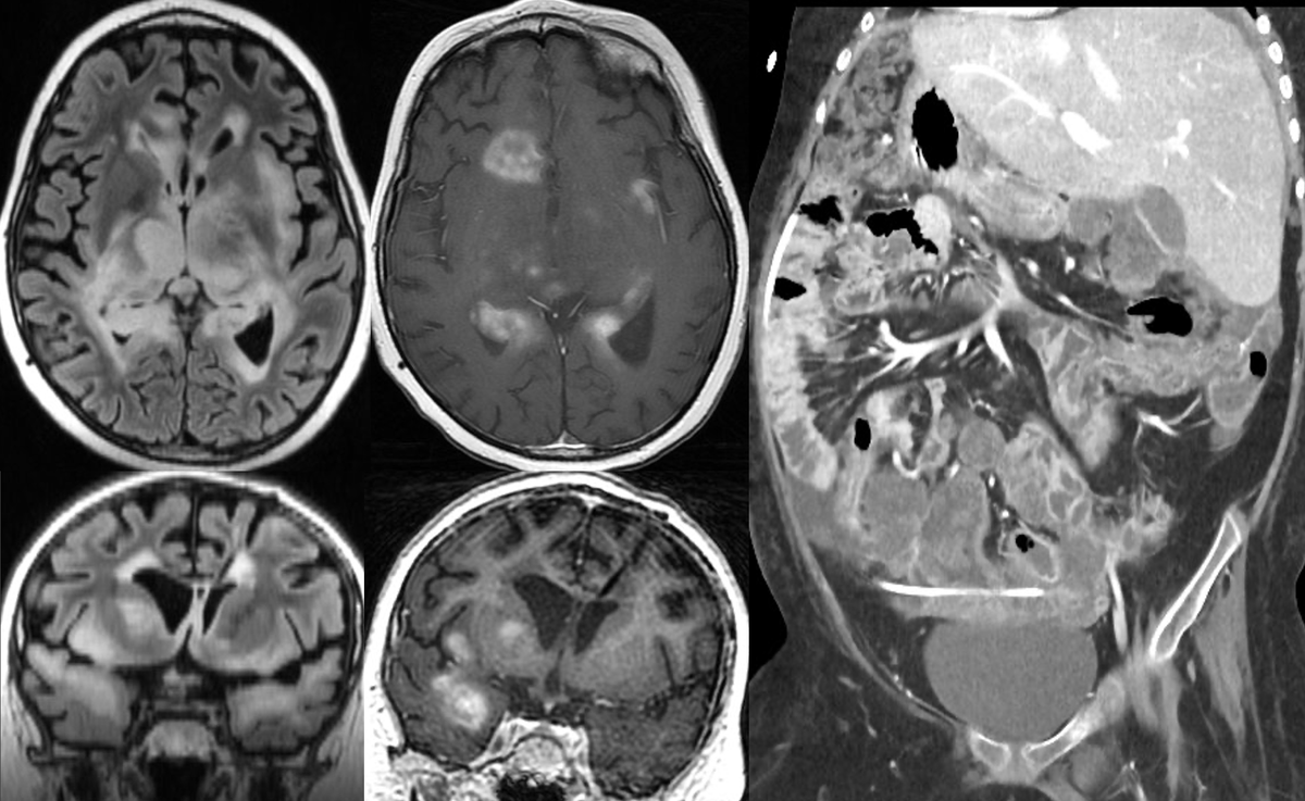 Evan Calabrese, MD PhD tweet media