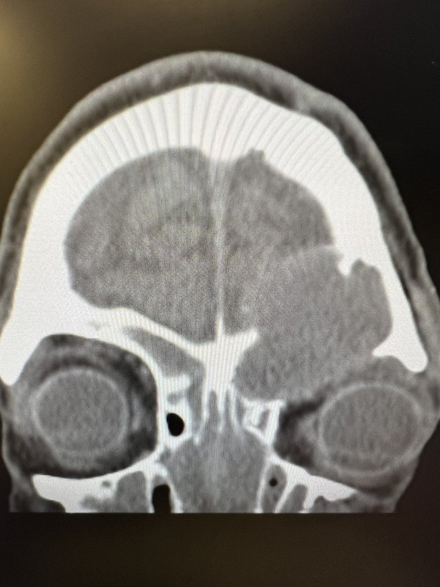 John Craig, MD tweet media