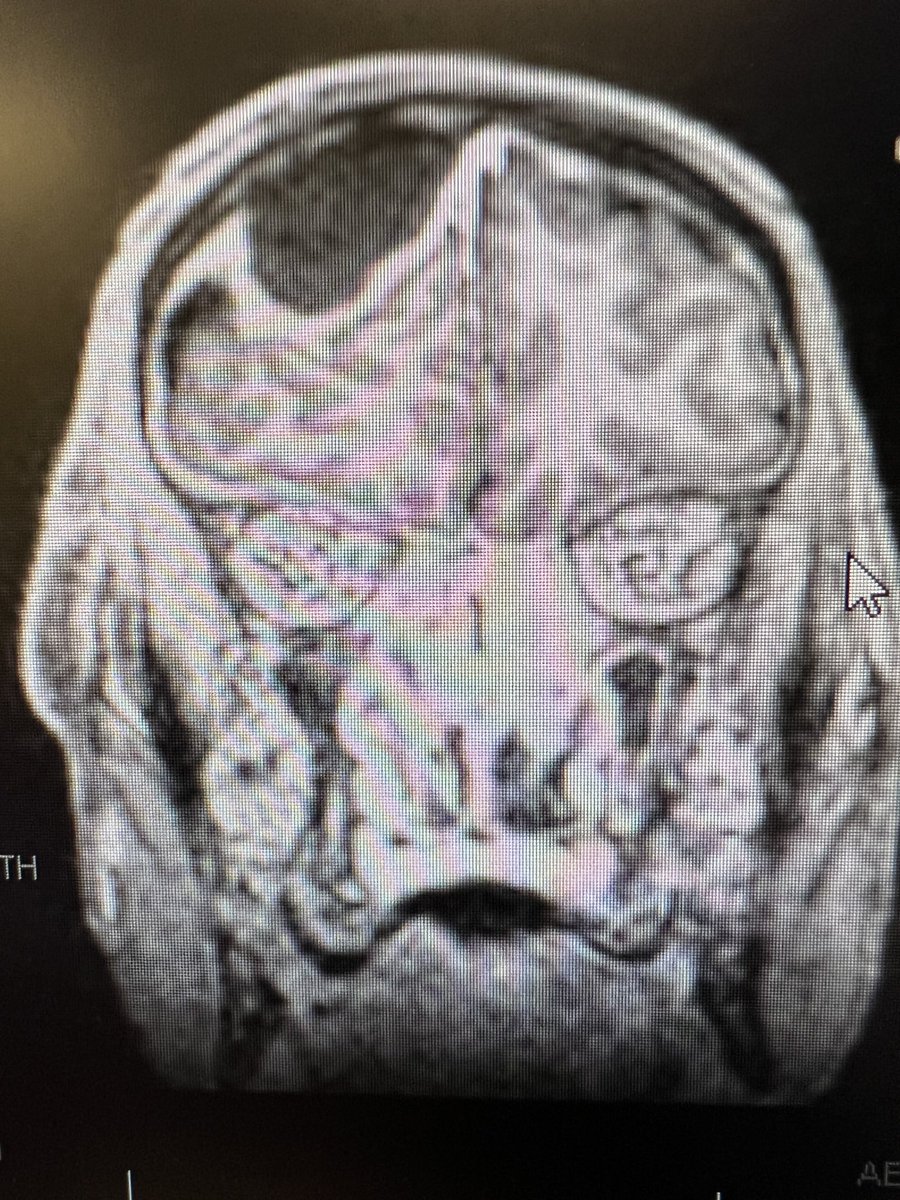 John Craig, MD tweet media