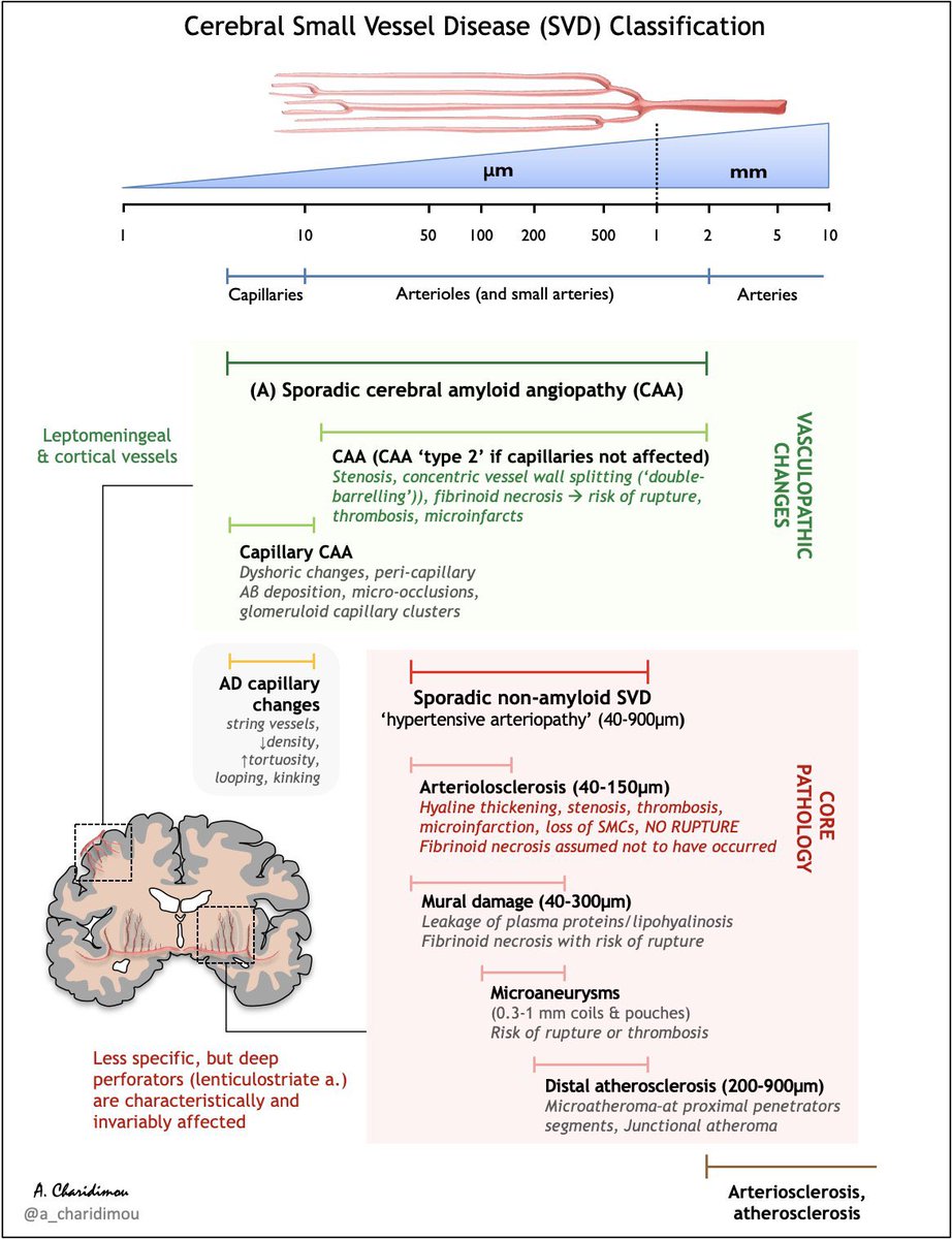 a_charidimou's tweet photo. 🧠⭕️Cerebral Small Vessel Disease Classification (v2) Scheme

☂️ For the 2 common sporadic forms
(Based on neuropath process🔬, vessel diameter, distribution)

👍Thank you @WorldStrokeEd @BoNorrving @SimonFaHo @interneurona @gsaposnik @laura_wsa & others for the nicely crafted webinar!

#MedTwitter #neurotwitter #MedEd #FOAMrad #NeuroTwitter #NeuroRad #Neurology #Neurosurgery #Stroke #dementia #Alzheimers #AmyloidAngiopathy #neuropathology #neuroscience #cSVD