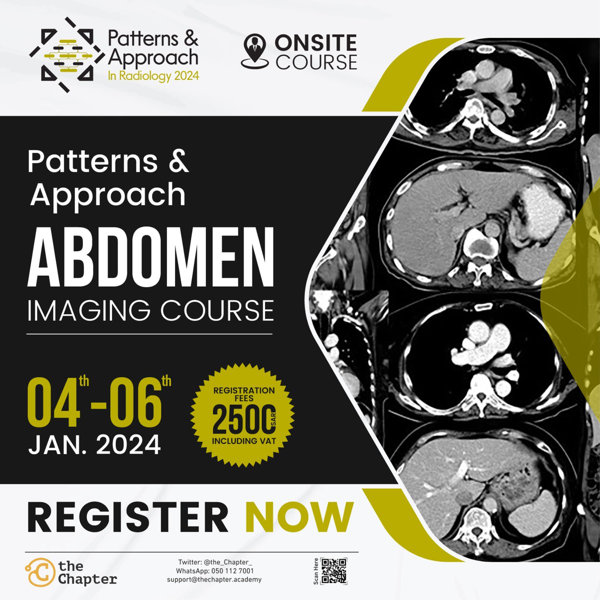 the_Chapter_'s tweet image. Exciting News! Join us at #theChapter for the exclusive "Patterns &amp;amp; Approach Abdomen Imaging Course" on Jan 4-6, 2024. Dive into Stomach Wall Abnormalities, Liver Lesions &amp;amp; more. Elevate your expertise! Limited seats available - secure yours now!
bit.ly/3SLUenB