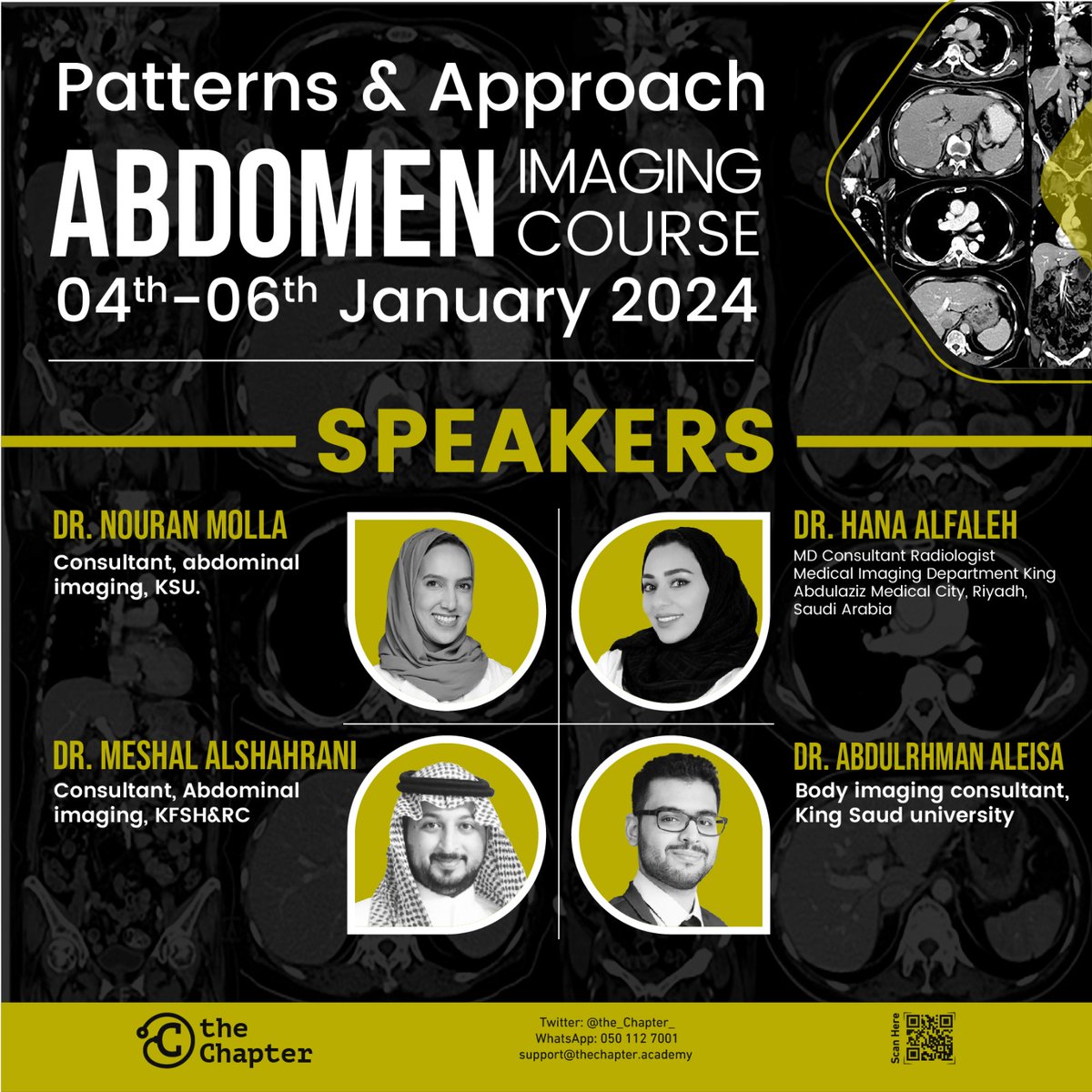 the_Chapter_'s tweet image. Exciting News! Join us at #theChapter for the exclusive "Patterns &amp;amp; Approach Abdomen Imaging Course" on Jan 4-6, 2024. Dive into Stomach Wall Abnormalities, Liver Lesions &amp;amp; more. Elevate your expertise! Limited seats available - secure yours now!
bit.ly/3SLUenB