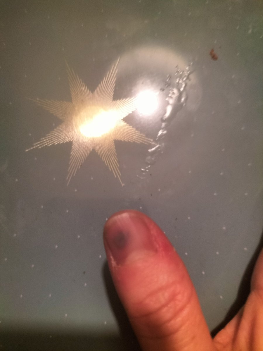 deambuleuse's tweet image. Cette journée de merde se termine par mettez fait claquer une porte sur mon pouce. D&apos; ailleurs si vous avez des conseils ça lance #teamdoc