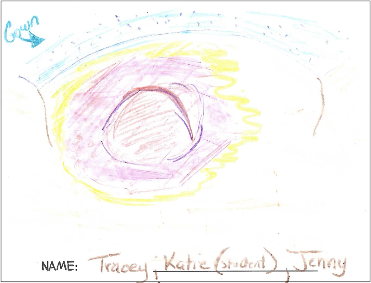 FistulaSolution's tweet photo. Fistula Solution is proud to unveil the Second Runner Ups of the 2023 #SAWC Fall #Fistula Coloring Contest!

https://t.co/drOPdtViaI

In a stroke of artistic genius, Tracey Yap, Katie Brooks, and Jenny Alderden unleashed their interpretation of an open abdomen.

Congratulations! https://t.co/x4s6lMqnFG