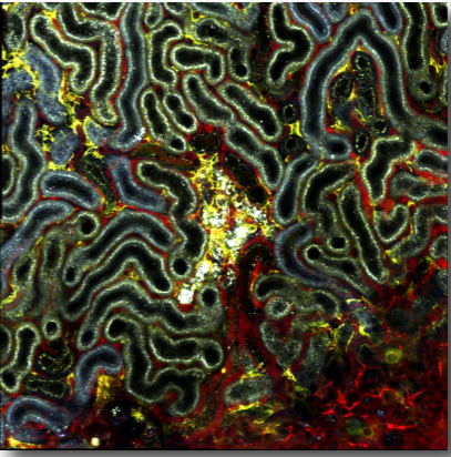 AJP Renal (@ajprenal) on Twitter photo 📢RESULTS ARE IN!
Clash of the Kidneys: Return of the Electrolytes Sci-Art Competition
🥇 1st Place (Student)
Sofie Kirchhoff-Jensen, Aarhus University
Image- Single nephron injury & interstitial cell recruitment a week after injury
<a href="/KirchhoffJensen/">Sofie Kirchhoff-Jensen</a>
ow.ly/xqU950Qa3EW 📢RESULTS ARE IN!
Clash of the Kidneys: Return of the Electrolytes Sci-Art Competition
🥇 1st Place (Student)
Sofie Kirchhoff-Jensen, Aarhus University
Image- Single nephron injury & interstitial cell recruitment a week after injury
<a href="/KirchhoffJensen/">Sofie Kirchhoff-Jensen</a>
ow.ly/xqU950Qa3EW