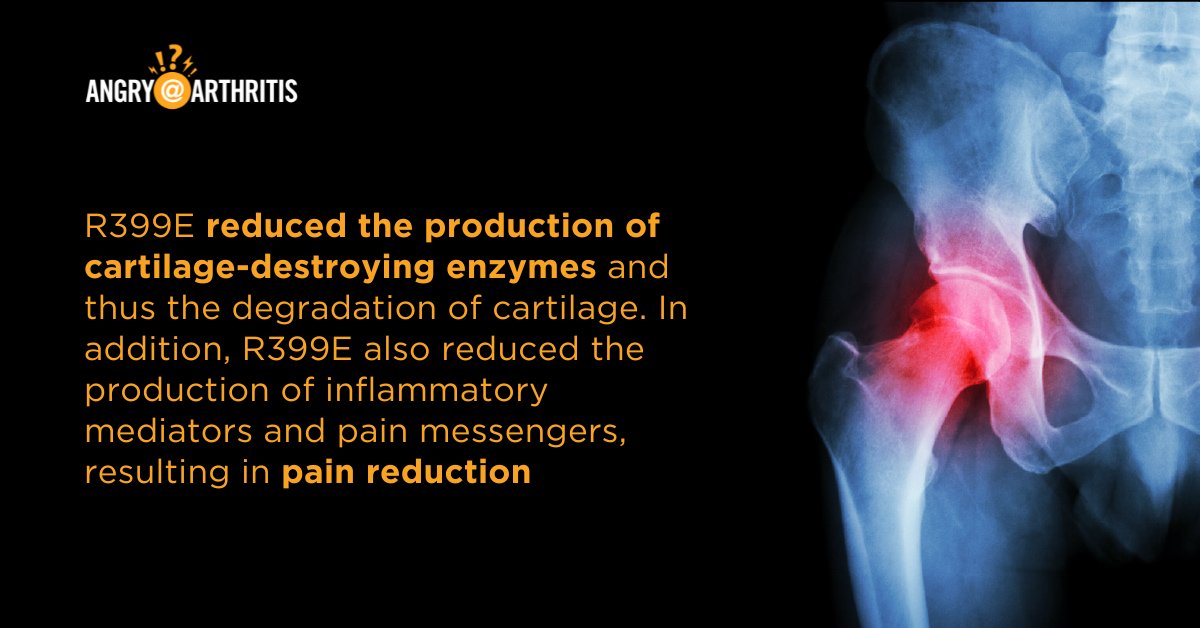 Did you know? 🦴 Check out these facts on R399E, a potential new treatment for #osteoarthritis:

angryarthritis.org/podcasts/innov…
