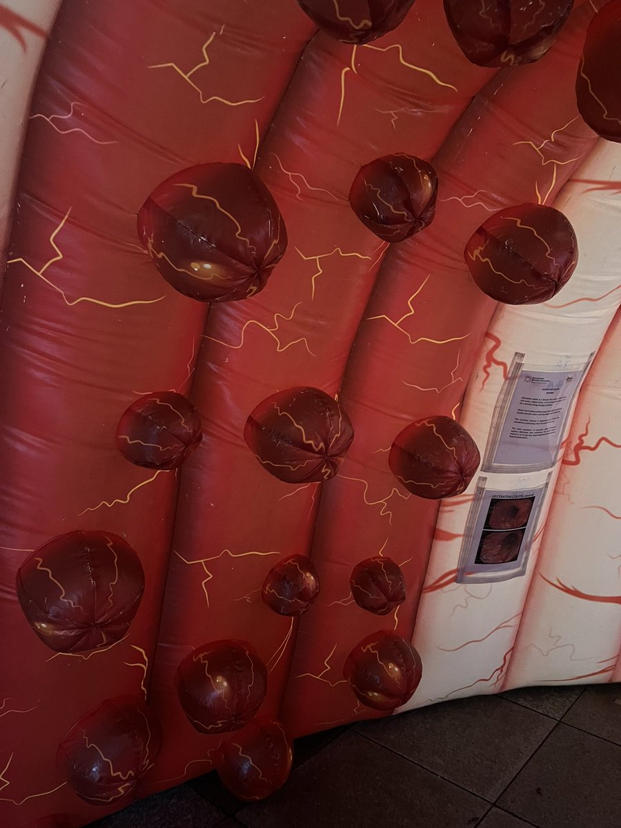 @bowelcanceruk awareness roadshow is in Cardiff. Walk through the inflatable bowel, and get advice on bowel cancer symptoms & signposting info. They’ll be outside the Capitol Shopping Centre tomorrow with @sarahdavies2110 from @CAV_PETeam & in Asda Carpark, Leckwith, Thursday.