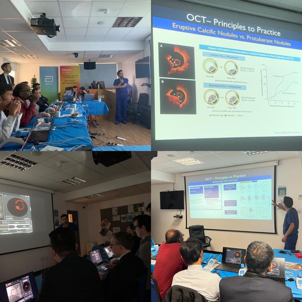 Charlotte Schrieken (@charlottecatha) on Twitter photo Today the 2nd P2P course with <a href="/DrNileshPareek/">Nilesh Pareek</a> <a href="/K_DeSilva/">Kalpa De Silva</a> <a href="/m_g_mcgarvey/">Michael McGarvey</a> and Ian Webb <a href="/KCH_Research/">King's College Hospital Research</a> 10 engaged customers, reviewing 15 cases, one LM LAD live case. #imagefirst #ultreon2.0 #MedEd #Abbottproud Today the 2nd P2P course with <a href="/DrNileshPareek/">Nilesh Pareek</a> <a href="/K_DeSilva/">Kalpa De Silva</a> <a href="/m_g_mcgarvey/">Michael McGarvey</a> and Ian Webb <a href="/KCH_Research/">King's College Hospital Research</a> 10 engaged customers, reviewing 15 cases, one LM LAD live case. #imagefirst #ultreon2.0 #MedEd #Abbottproud