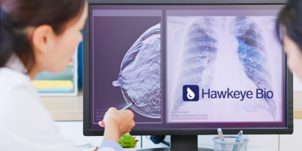 PooleTeena79125's tweet photo. Exciting news in the world of #MedicalTech! ๐ฉบ Introducing Hawkeye Bio, revolutionizing lung cancer diagnosis. Nicole Junkermann ๐ฌ๐ #HealthTech #Innovation #Junkerman https://t.co/xM4txaabfU