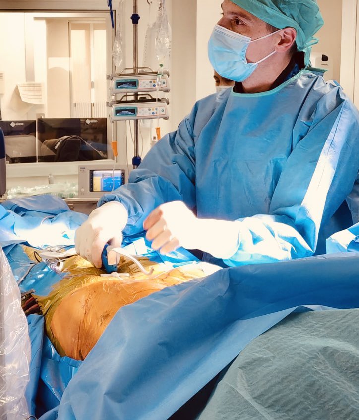 Pau79_EP's tweet photo. First successful extravascular ICD implant today at @hbellvitge. Thanks to our great EP team, thanks to all @MDT_Cardiac staff for supporting this new revolutionary technology, thanks to Dr. Jaime Casares for his teaching and advices! Será la Aurora! https://t.co/GZq1Go1haU