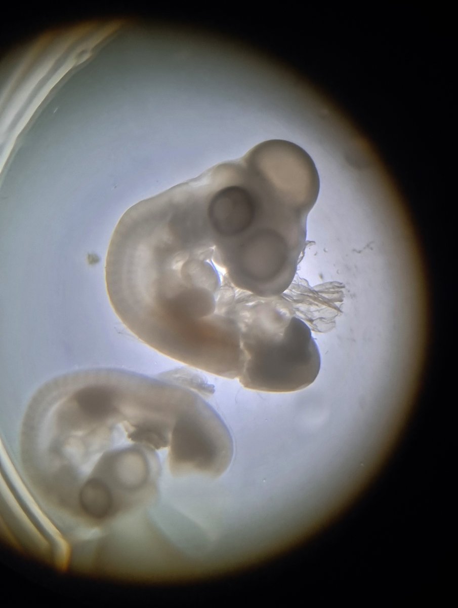 🔬 [Projet Développement Embryonnaire] 🔬 
C'est parti pour le poulet à Mermoz ! Animal-modèle préféré de Sandrine Faure, Pascal de Santa Barbara et Salomé Ruiz Demoulin du laboratoire PHYMEDEXP. Les questions fusent sur leurs parcours, le développement de cet embryon !🤩🐔🥚