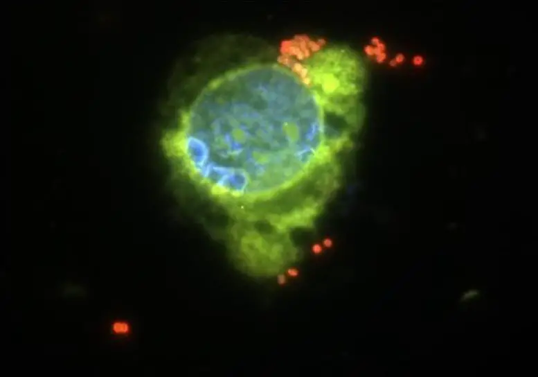 evelio_prieto's tweet photo. 🧠🦠RESURGIMIENTO SIN PRECEDENTES DE LA MENINGITIS MENINGOCÓCICA INVASIVA🦠🧠
1⃣Un equipo de investigadores del Instituto Pasteur analizó la progresión en Francia de 2015 a 2022.
Sus hallazgos, que se publicaron recientemente en el Journal of Infection and Public Health, indican una importante resurgimiento de la enfermedad
2⃣Destaca un cambio en el patrón de la enfermedad, con un aumento de los casos causados ​​por serogrupos meningocócicos que antes de la pandemia eran menos comunes.
Ha habido un aumento de infecciones entre personas de 16 a 24 años.
Recomiendan a los adolescentes la vacuna meningocócica tetravalente de los serogrupos A, C, Y y W
🤦‍♂️VUELVEN A CULPAR A CONFINAMIENTOS+MASCARILLA+DISTANCIA🤦‍♂️
‼️Incluso mencionan que el virus de la gripe favorece la infección meningocócia, PERO OCULTANDO SARS2‼️