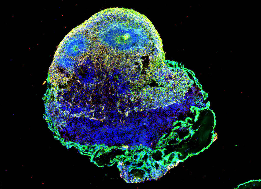 UQ News (@uq_news) on Twitter photo University of Queensland researchers have found a way to reverse a cellular process triggered by COVID-19 that contributes to premature ageing of the brain 🧠
Read more: brnw.ch/21wEE6B
<a href="/AIBNatUQ/">AIBN Research</a> <a href="/JulioAguado_PhD/">Julio Aguado</a> <a href="/Wolvejong/">Ernst Wolvetang</a> University of Queensland researchers have found a way to reverse a cellular process triggered by COVID-19 that contributes to premature ageing of the brain 🧠
Read more: brnw.ch/21wEE6B
<a href="/AIBNatUQ/">AIBN Research</a> <a href="/JulioAguado_PhD/">Julio Aguado</a> <a href="/Wolvejong/">Ernst Wolvetang</a>