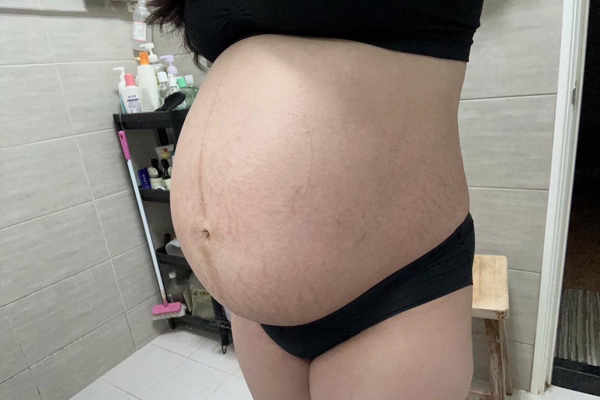 WanDa96563996's tweet photo. 關於11月4日早上7點半破水落紅
9點就在我的產檢診所待產
本以為半夜0點前就會出來殊不知..
就這樣一直耗到隔日早晨6點37分才分娩出來
這關主線任務花了我快24H
醫生：7點生不出來好像就要破腹了
護士：媽媽 你憋氣出力不能漏氣
不然時間到 要剖腹喔！
兩個護士齊力的用手肘猛壓我肚子..
簡直人生跑馬燈 https://t.co/WE8s1EuL88