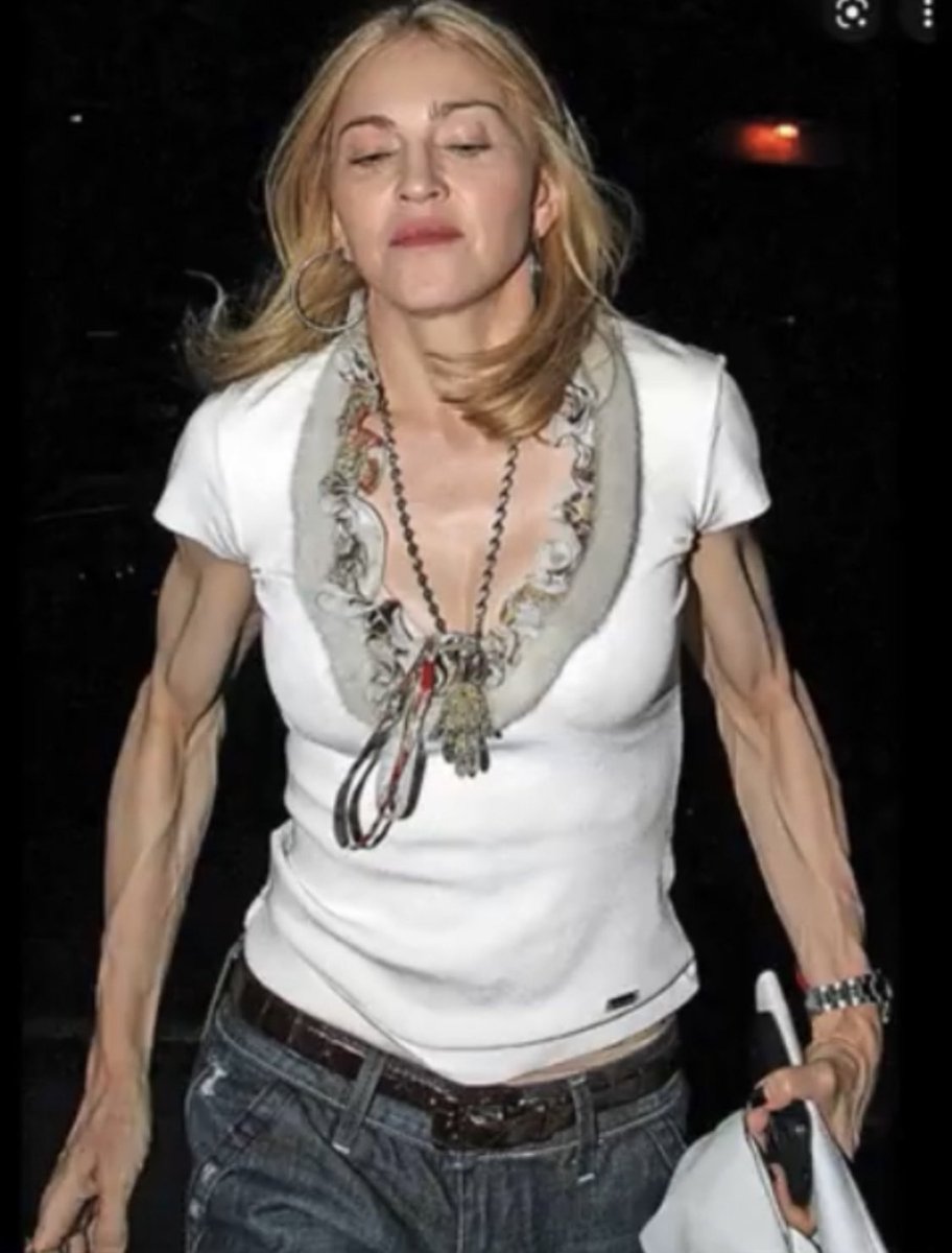 ReturnOfKappy's tweet photo. What's up with Madonna's arms...?

#WeWantAnswers #Madonna https://t.co/iTPlefn7vl