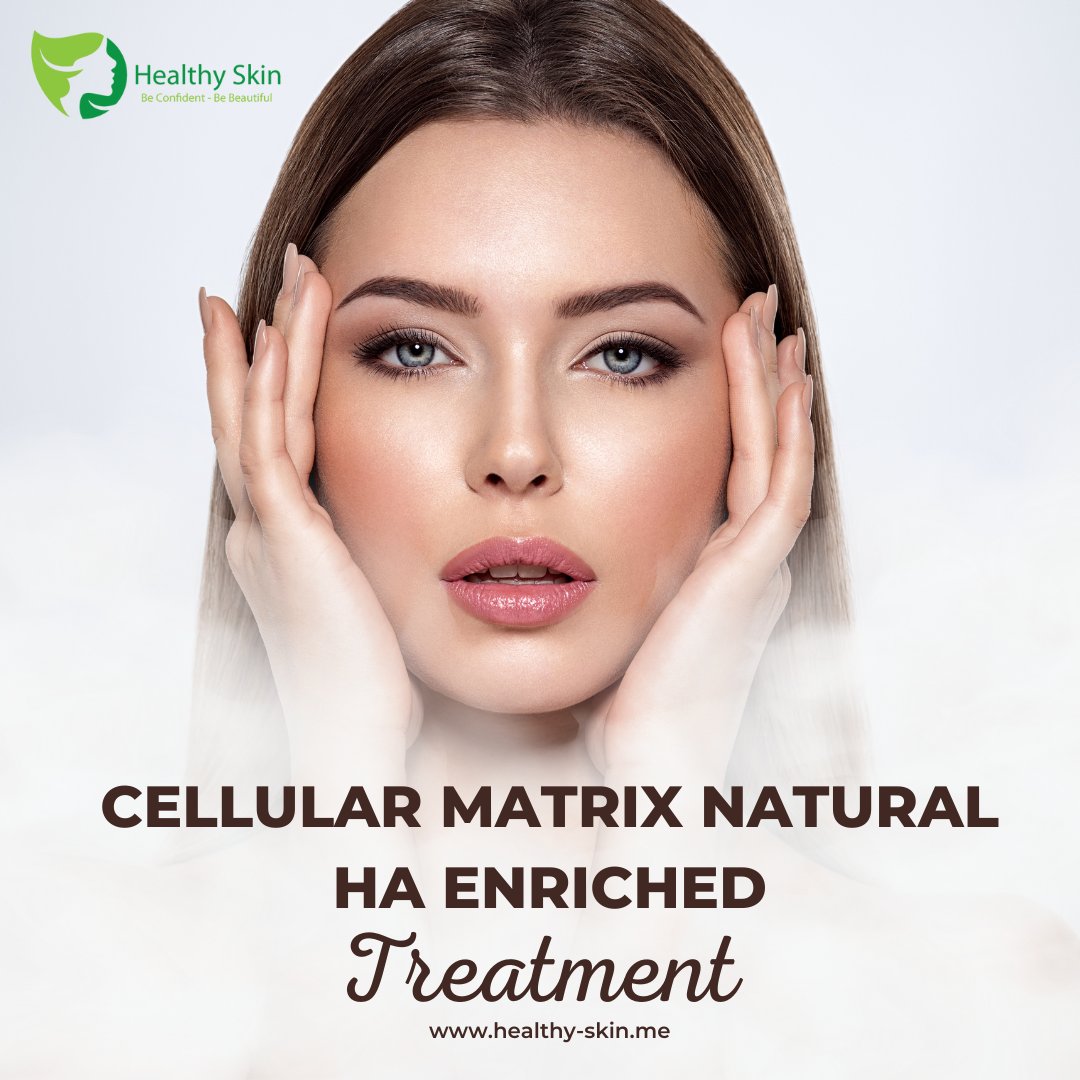 HealthySkinHKT's tweet image. Introducing a revolutionary innovation in skin care - ✨Cellular Matrix Natural HA enriched with your Platelets Growth Factors and Regen PRP✨ - to bring you superior natural results.

Learn more here 👉 pulse.ly/l1mpugkzml

#HealthySkin #CellularMatrix #NaturalHA #SkinCare