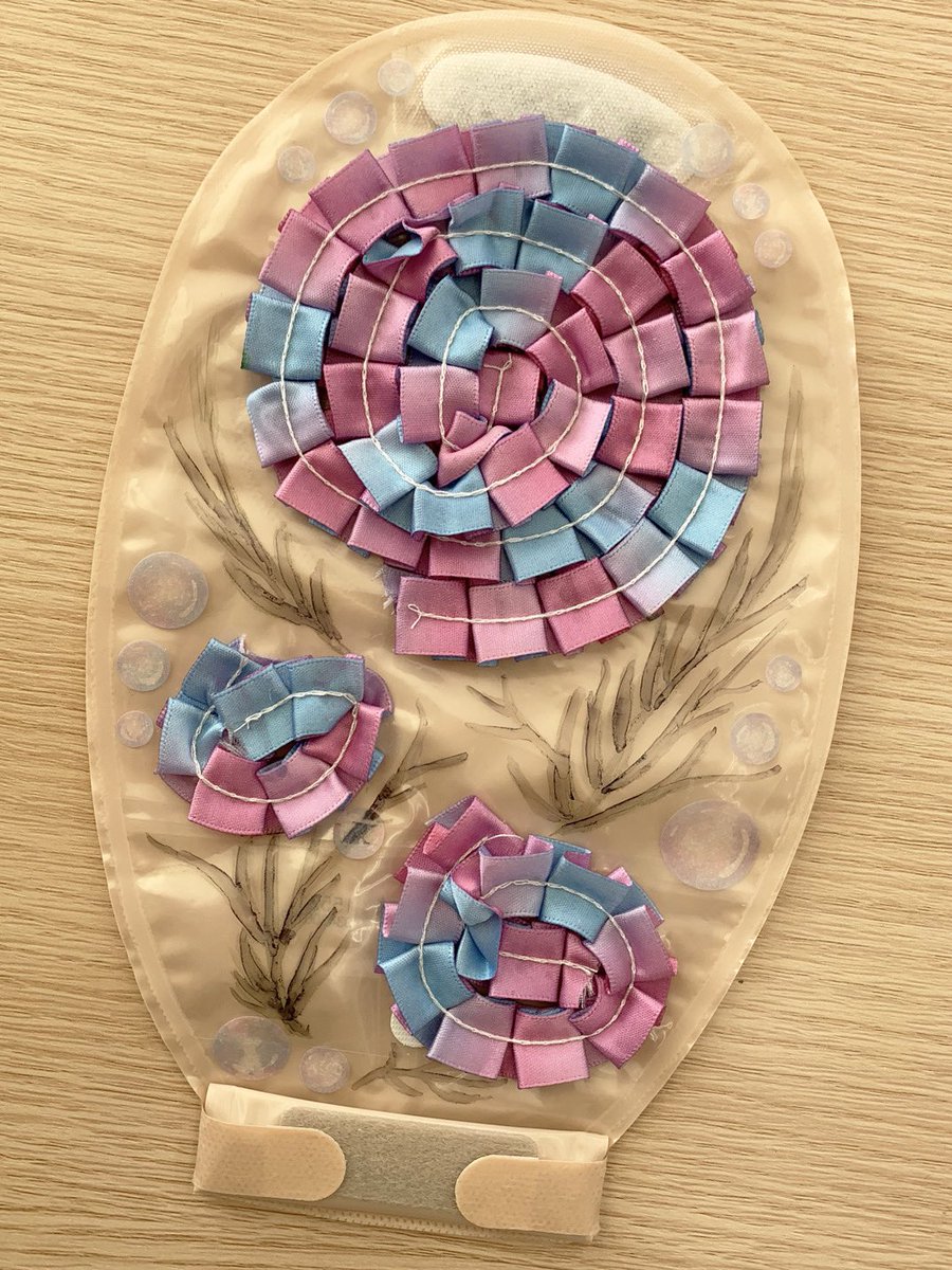 Araimedical's tweet image. デコパウチ投稿　第7弾💖

🌷お花が素敵なパウチ2種類の紹介🌷

1つ目は赤ちゃんがかぶるズキンのようなデザインのパウチ👶
ストーマを囲うよなお花が素敵です💕

2つ目はカラフルな大きなお花のパウチ🌸
実はこちらはリボンを使って作られています🎀

日々の生活に癒しをくれるお花です💐

#DPC2023