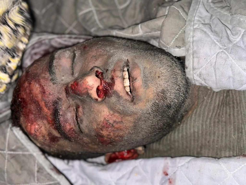 IATeam___'s tweet photo. innalillahi wa innailaihi raji'un..
🇵🇸Syahid Muhammad Ayyash, direktur saluran Gaza Live Telegram

"Kami mohon maaf karena kami kurang update hari ini,krn Kami skrg  mengevakuasi keluarga syuhada,Saudara Mustafa Ayyash,yg keluarganya masih ada di bwh reruntuhan.
(Tulis: Gaza Now) https://t.co/riZ2xOHAnK