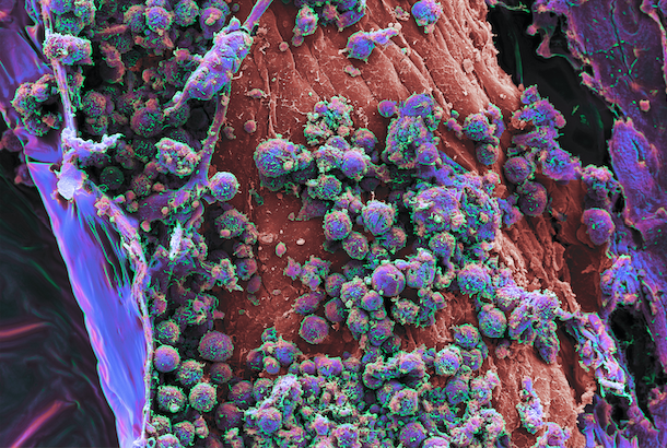 .<a href="/vivodyne/">Vivodyne</a>'s Lab Grown Human Tissue Platform Gets Real with $38 Million Seed Financing

Vivodyne’s #AI driven platform is used to discover and develop drugs by testing directly on lab-grown human organ tissues. Learn more: ow.ly/69zN50QalZv