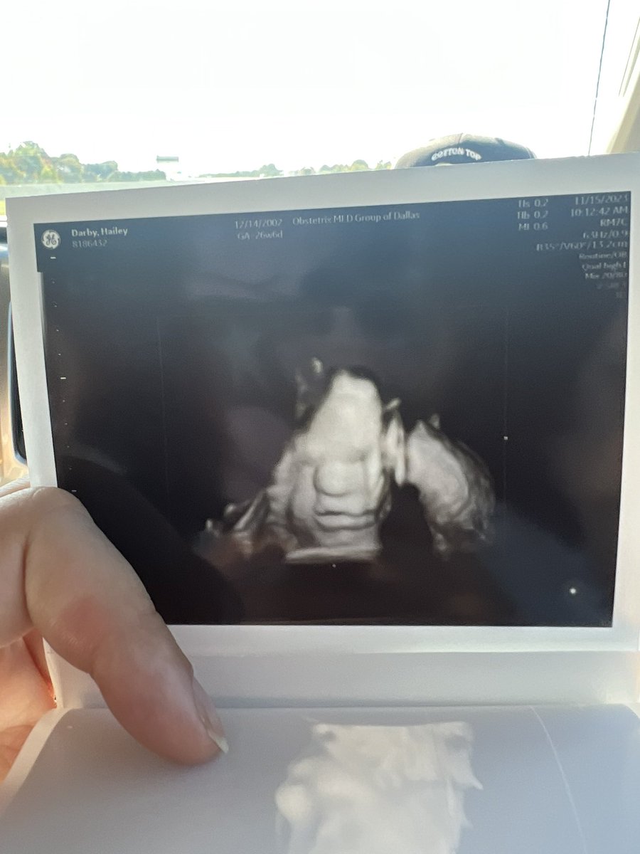 HaileyDarby03's tweet photo. Can’t wait to hold my sweet baby 🫶🏼 https://t.co/rxBqsgHxZM