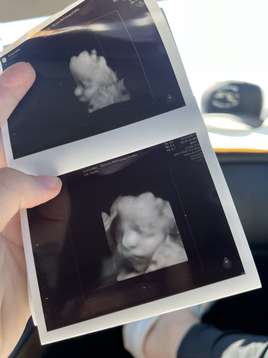 HaileyDarby03's tweet photo. Can’t wait to hold my sweet baby 🫶🏼 https://t.co/rxBqsgHxZM