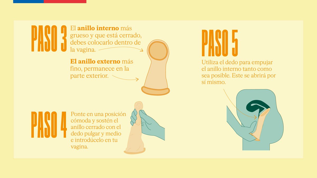 Salud_Responde's tweet image. #CondónInterno o de vagina.
Conoce más de él y recuerda que no solo sirve para la prevención de embarazo no deseado, sino que también para el VIH/SIDA e Infecciones de transmisión sexual (ITS) como la gonorrea, clamidia y tricomoniasis🛡️