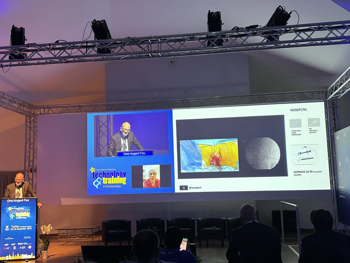 Day 1 of #Technologyandtraining congress hosted by @scoffonecesare in #Cottolengo hospital in Turin. Interesting lectures and live surgeries. Doctor @oangerri shows how to perform a #MiniPERC with optimal results! @FPuigvert