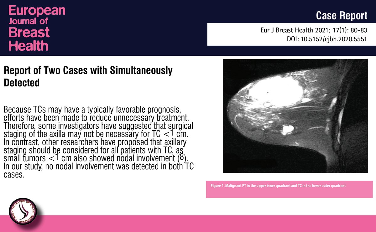 Report of Two Cases with Simultaneously Detected Tubular Carcinoma and Phyllodes Tumor of the Breast

You can see the free full text of the research by Burak İlhan et al.

Link : cms.galenos.com.tr/Uploads/Articl…

#Breast #phyllodestumor #surgery #tubularcarcinoma