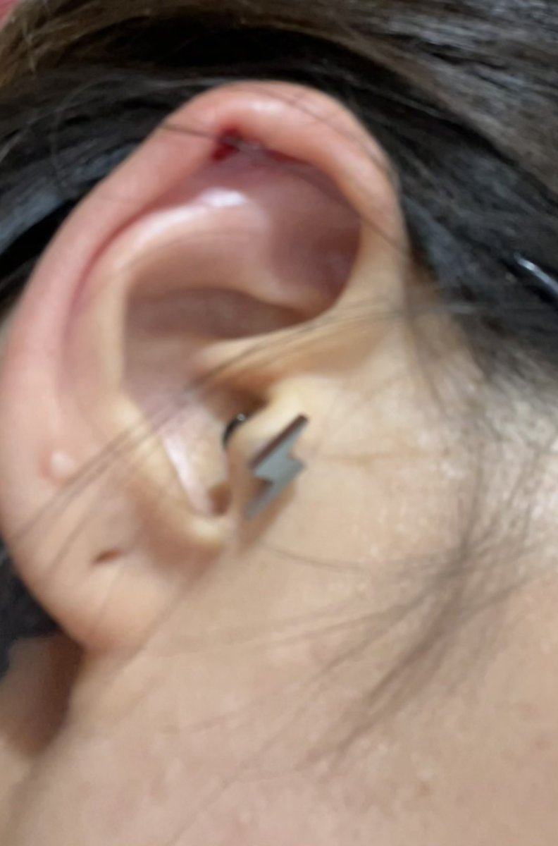 ヨウムに軟骨噛まれた(反対側も)
絶対