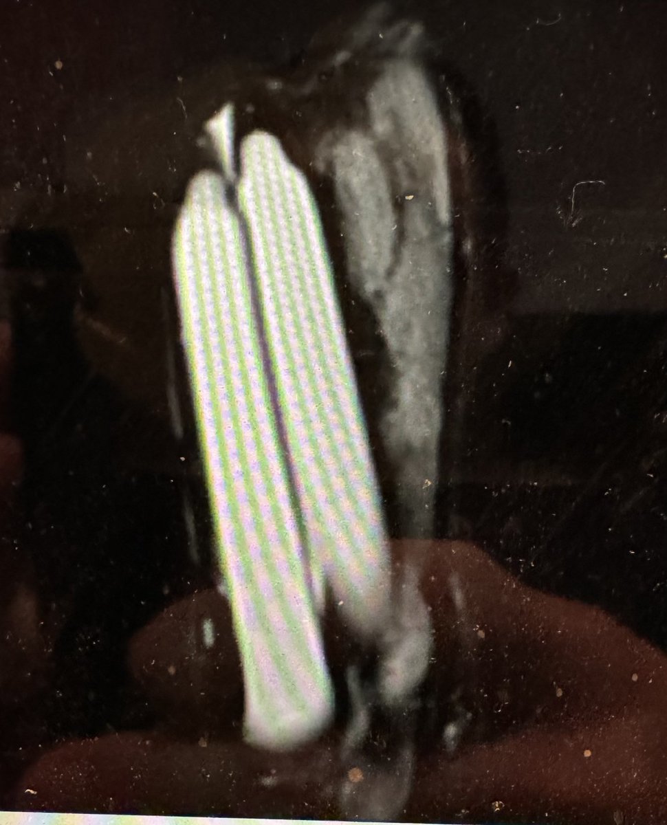 donwglee's tweet photo. Proud of our Andrology Fellow @danielafleckl from @uclh presenting a difficult clinical case with cylinder crossover and erosion #esuerectile23 @UrowebESU https://t.co/48YSEC4CYQ