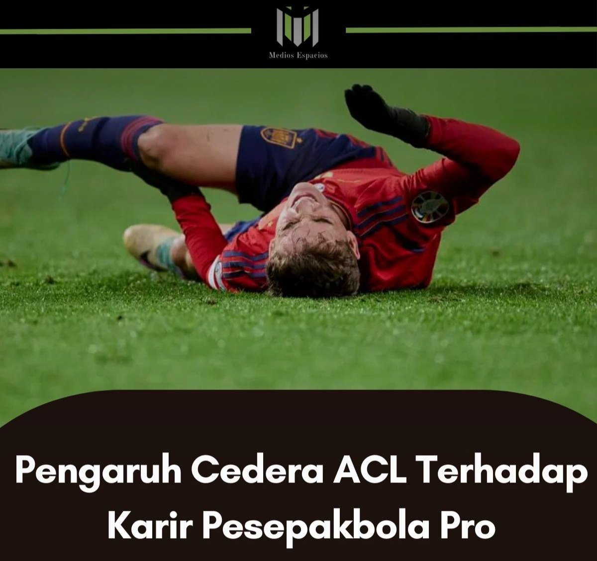 MediosEspacios's tweet photo. Pengaruh cedera ACL terhadap Karir Pesepakbola

Anterior Cruciate Ligamen adalah sebuah mimpi buruk bagi para pemain sepakbola. Tak jarang pemain menjadi sedikit bermain lebih berhati-hati setelah mengalami cedera ini. Berikut ulasannya…
#ACL

A THREAD https://t.co/aFgr3ZSLT9