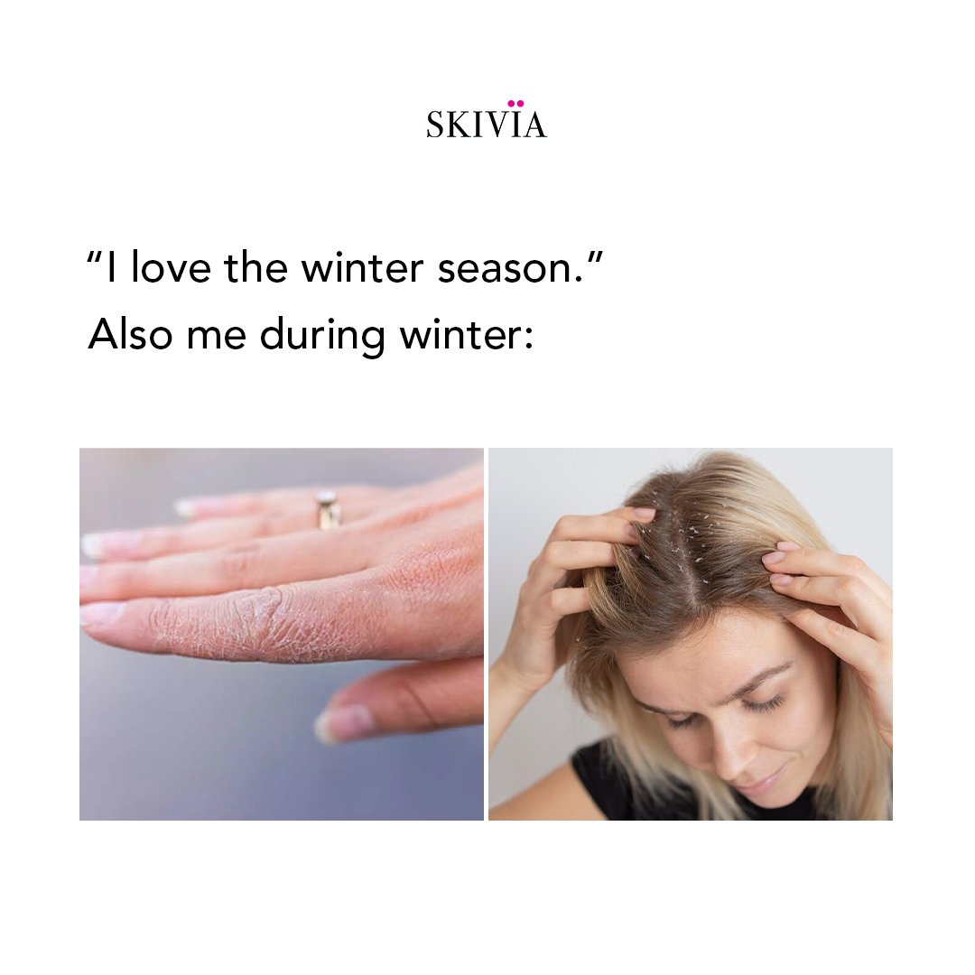 skivia_'s tweet photo. Do you love winters but hate dry skin &amp; dandruff? We feel you! 😭

#skivia #skiviaskincare #Skinship #skincare #skinnydip #Skin #Skins #haircare #hairstyle #hairtransformation #WinterIsComing #WinterWarmth #Memes #MemeContest https://t.co/AZGfgImalN