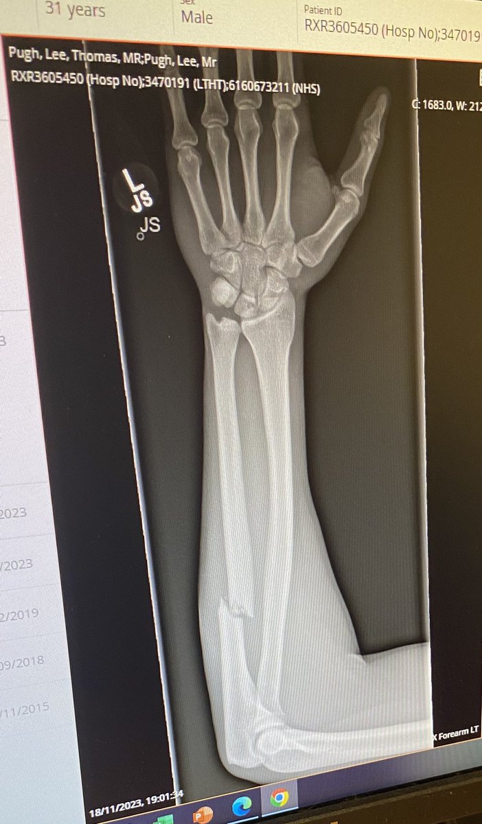 Lee Pugh tweet media