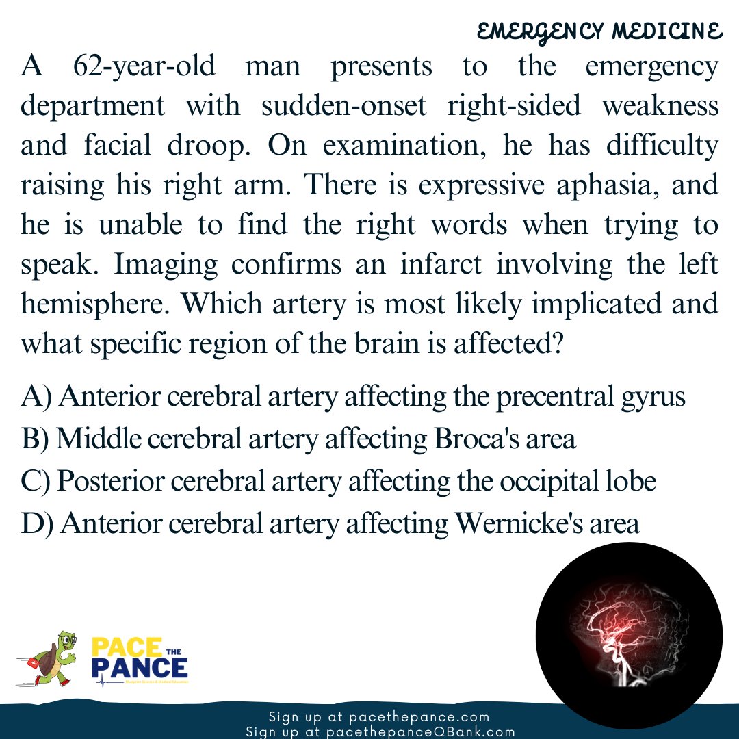 PaceThePance's tweet photo. Daily QBank practice problems for #PANCE #PANRE #PASchool #MedSchool #prePA #physicianassistant
#anatomy and more! Swipe to reveal answers, explanations, and PACE The PANCE Pearls. Sign up for memberships at https://t.co/3NA4uIbE9e or https://t.co/vnzTytDlFI #meded #medtwitter https://t.co/fL0eihVMsy