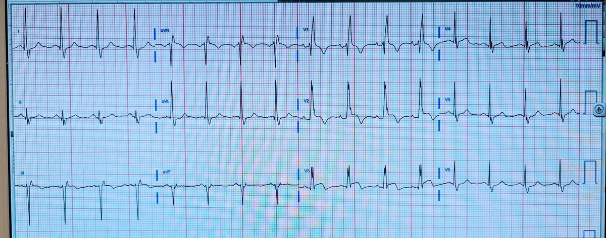 Brooks Walsh tweet media