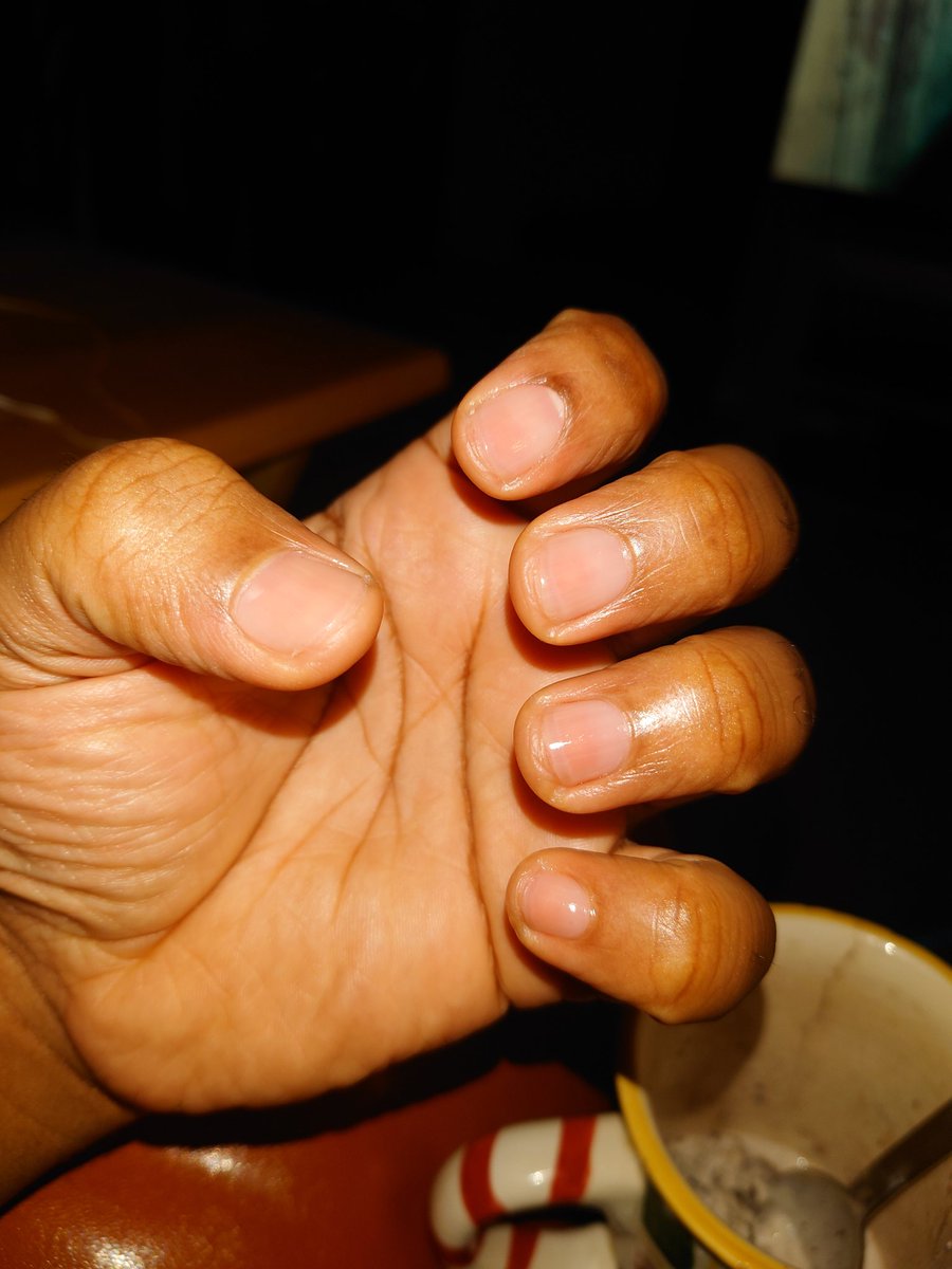 BrownTiger73's tweet photo. Yeah I do my own nails wassup!
Fellas step ya self care game up
💅🏾
#Moisturized #ManHand https://t.co/QTzQayMtn1