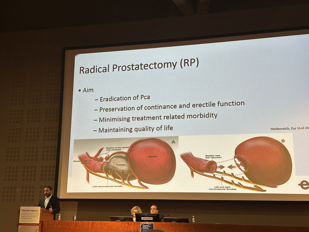 OsmonovDr's tweet photo. Great state of the art lecture on ED prevention and treatment from the master @drserefoglu the chief editor of @yoursexmedjour on @ESGURS2023 in sunny Florence https://t.co/FLzFAMhl6G