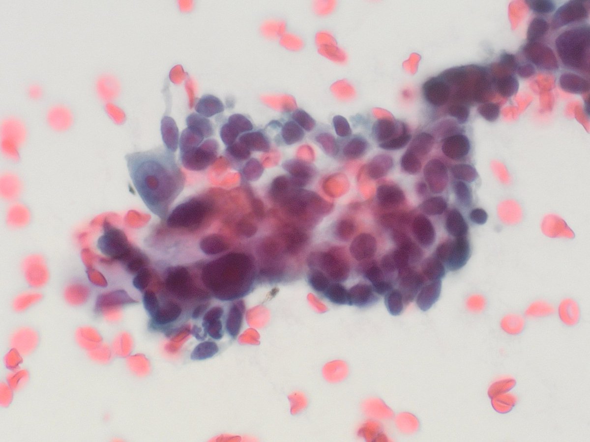 TotalCytopath tweet picture