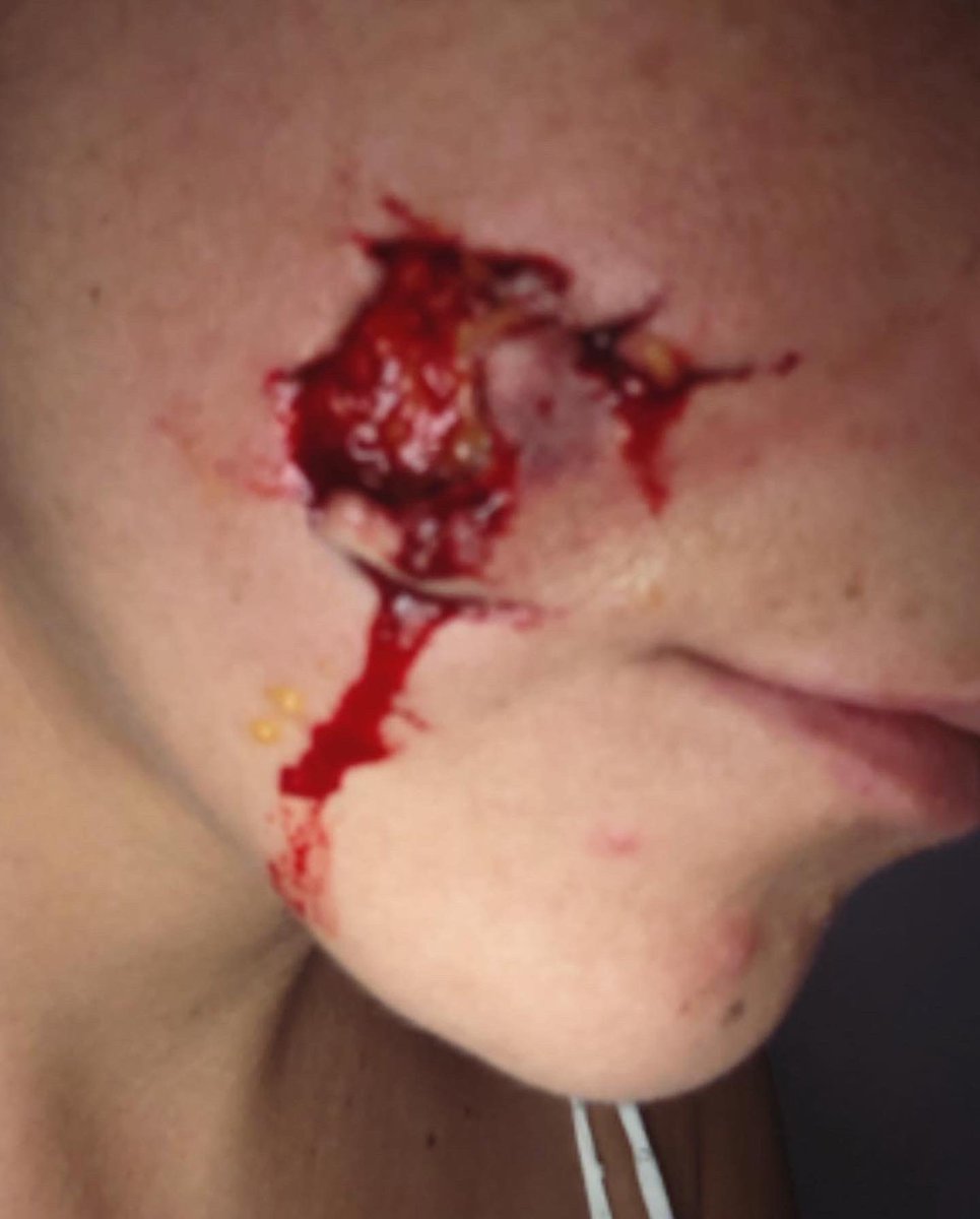 nathalytoledo's tweet photo. Detrás de una cicatriz siempre hay una historia, esta es la historia de la mía. Lo compartí ayer en otra red con muchos mensajes de identificación. Si has padecido algún trastorno mental y si te preocupa el bienestar animal este mensaje es para ti. ♥️ https://t.co/lwp0gRNd5G
