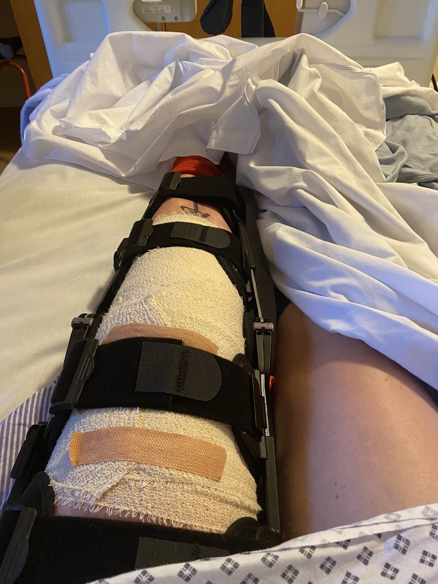 mrsgibbo78's tweet photo. A year today since my ACL operation. Recovery has been (is) a long hard slog, but I’m slowly getting there.
Aiming to be running again before Christmas 🏃🏼♀️
Be careful to not fall down the stairs people!
#acl #aclrecovery #aclreconstruction #hardslog #gettingthere https://t.co/477cq09Q7y