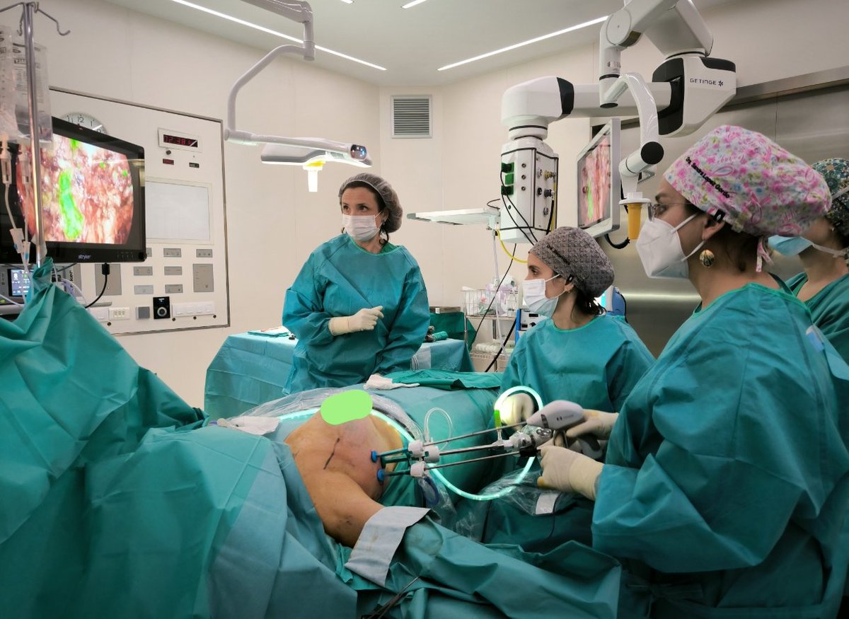 Endoscopic axillary lymphadenectomy in <a href="/CSdMaresme/">Consorci Sanitari del Maresme</a>. Improving the learning courve.Thanks to all the team! <a href="/EBombuy/">Ernest Bombuy</a> , Benavides, Garcia and nursing team!