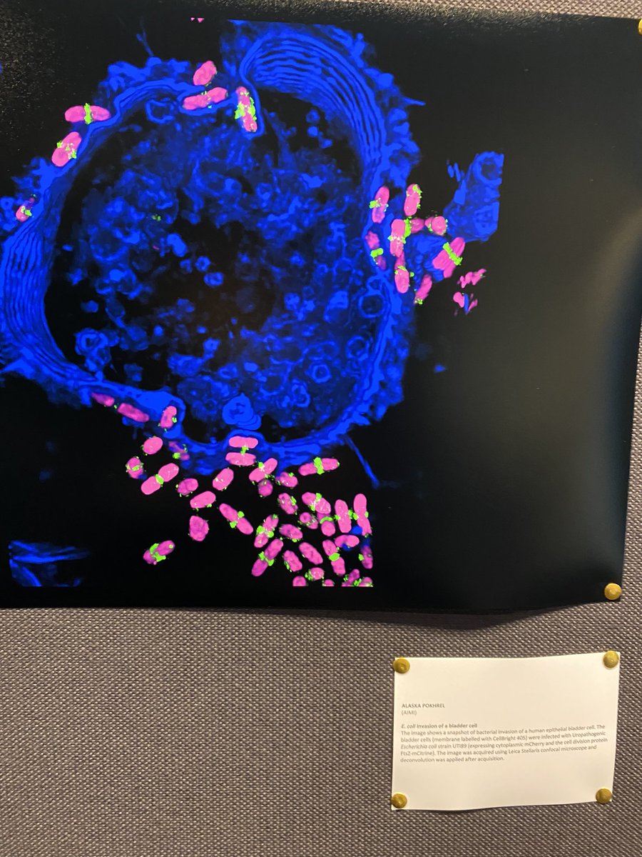 ColeLouiseUTS's tweet photo. @sonjzzz @AlaskaPokhrel @AIMI_UTS @UTS_Science @UTSResearch @micro_au Leica Stellaris @LeicaMicro @MarkPotten @AmarettePeters1 - zoom in on description below https://t.co/8xpL1dP4AO
