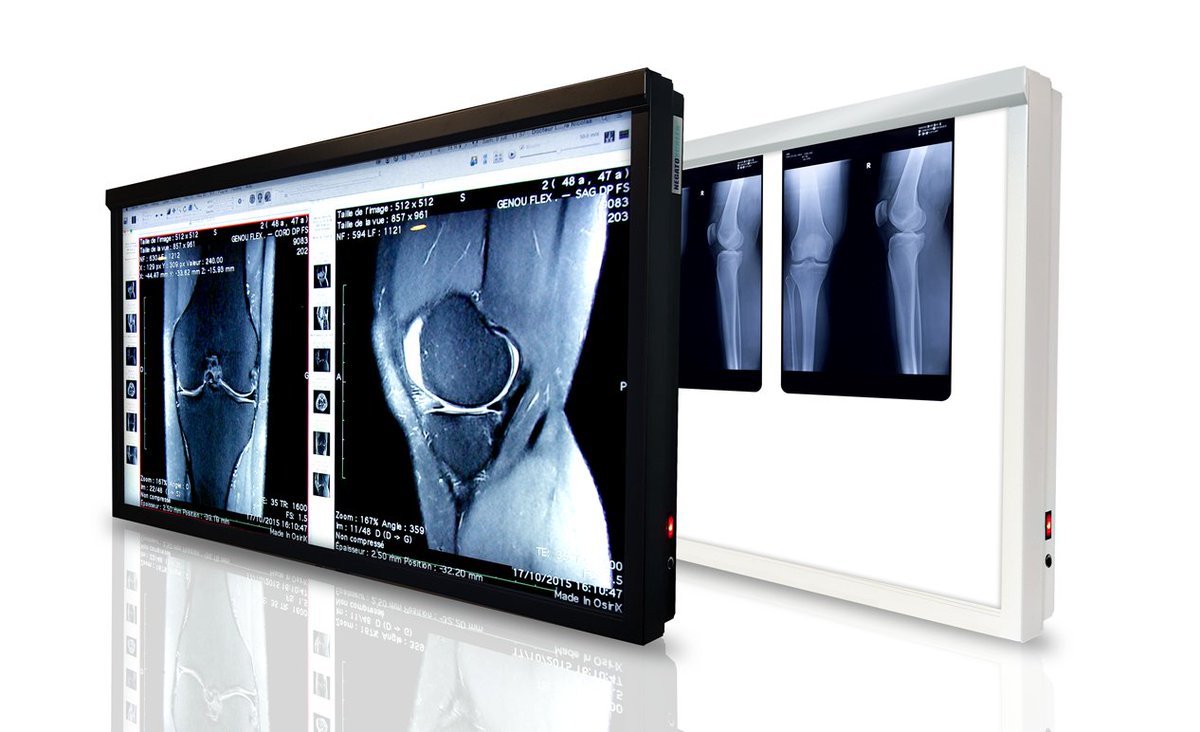Negatoscreen1's tweet photo. 🚨 Rendez-vous le 25 novembre 2023 aux Salons de L’Aveyron pour le 6ème Congrès de Chirurgie du Sport !

👉 Testez le #Negatoscreen
👉 Le Negatoscreen 43" 700 cd/m² à 2790€ (au lieu de 3990€)

📍 Rendez-vous :
LES SALONS DE L'AVEYRON
17, rue de l'Aubrac
75012 PARIS https://t.co/R4c7fiYuBe