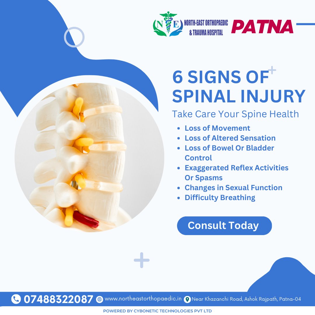 🚨 Know the Signs! 🚑 Spine injuries are serious business. Stay informed and spread the word about these 6 crucial signs that could indicate a spine injury.

🌐northeastorthopaedic.in

#SpineInjury #SpinalInjury #SpinalHealth #SpineSafety #InjuryAwareness #KnowTheSigns  #patna