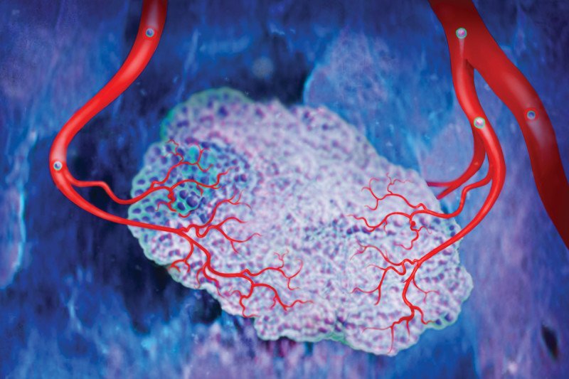 "🔬 Unlocking the power of angiogenesis! This natural process involves the formation of new blood vessels, crucial for tissue growth and repair. Exciting research continues to unveil its potential in treating various diseases. #Angiogenesis #MedicalBreakthroughs"