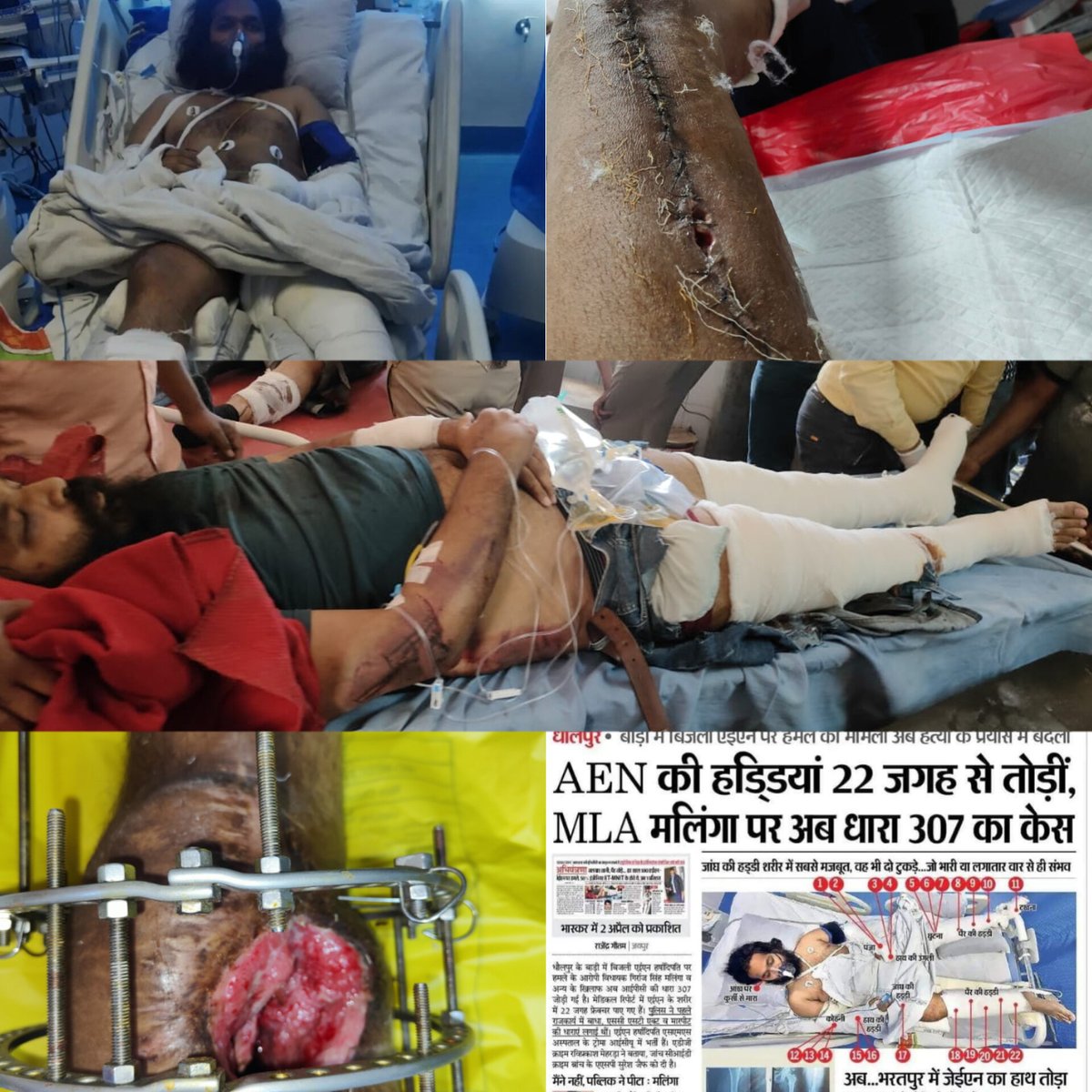 परिवार का लाड़ला,दोस्तों का जिगरी,भविष्य के सपने बुनता महज़ 27 साल का युवक।क्या गलती थी <a href="/Harshadhipati/">हर्षाधिपति</a> की वो एक कमरे में 2साल से जीवन बिताने को मजबूर हैं।"जन प्रतिनिधि" का "कहर" है ये।जघन्य अपराधियों की,जानवरों की,राजनीति में कोई जगह नहीं है।आज हर्षाधिपति है, कल आप और हम होंगे।