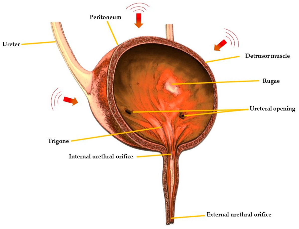 Pharmaceut_MDPI's tweet photo. The #published article on our #Pharmaceuticals 🤗

Drug Delivery Approaches for Managing Overactive Bladder (OAB): A Systematic Review by Khizer et al.

Enjoy reading:
https://t.co/WgBXdGluQo https://t.co/7V7XrLsB75