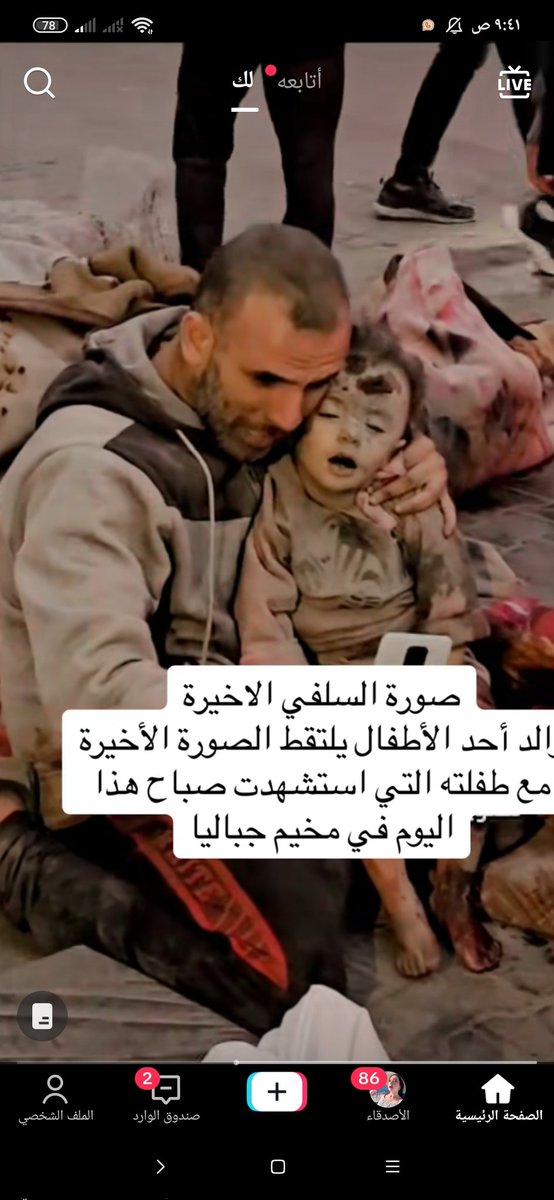 ابتسمي لأجل أبيك
ابتسمي فأنت الآن أجمل
ابتسمي ورفرفي لجنة الله 💔