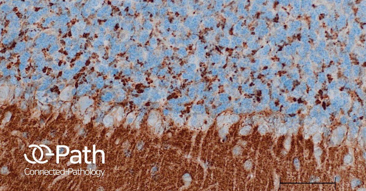 C_Pathology's tweet photo. At Connected-Pathology we frequently evaluate pathology of neuromuscular such as ALS as well as neurodegenerative diseases including Alzheimer's disease, Parkinson's disease.  

Interested? Start a project now: https://t.co/kZtbzHNnUM https://t.co/3iKQCnHuhe