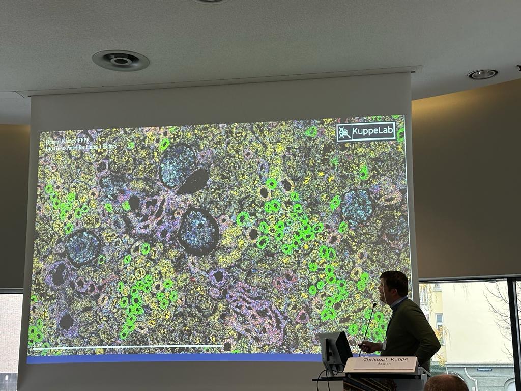 Christoph Kuppe (@kuppechristoph) on Twitter photo 1/3🎉 Exciting News! I'm thrilled to announce my new role as Professor at <a href="/RWTH/">RWTH Aachen</a> & <a href="/UniklinikAachen/">Uniklinik RWTH AC</a>. Our focus? Integrative analysis of single-cell spatial multiomics data from human tissues and in vitro models. DM for a position in our team! Our goal: 1/3🎉 Exciting News! I'm thrilled to announce my new role as Professor at <a href="/RWTH/">RWTH Aachen</a> & <a href="/UniklinikAachen/">Uniklinik RWTH AC</a>. Our focus? Integrative analysis of single-cell spatial multiomics data from human tissues and in vitro models. DM for a position in our team! Our goal: